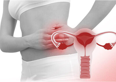 pelvic inflammatory disease